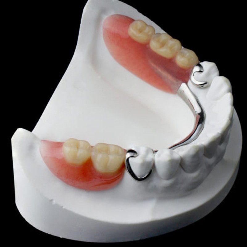 Dentures & Partials Creve Coeur, MO - Perfect Smiles STL